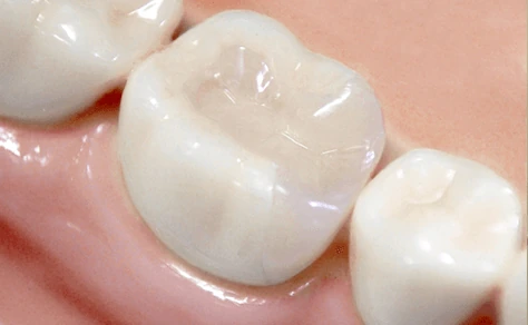 傷に強く汚れがつきにくいイメージ